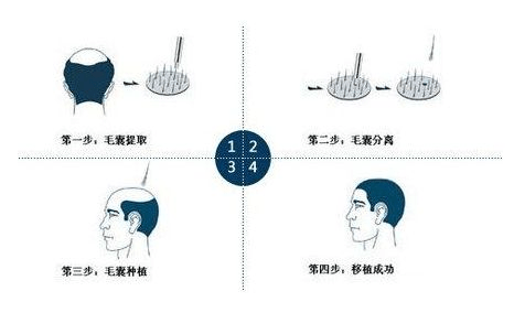 肉类与脱锌技术的关系